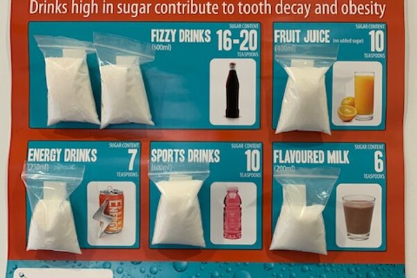 SUGAR - A tooth's worst enemy