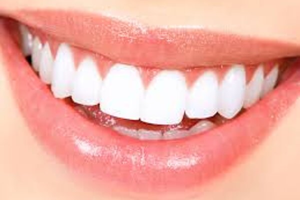 Singing Dentist - Tooth Whitening